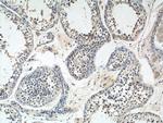 WDR40A Antibody in Immunohistochemistry (Paraffin) (IHC (P))