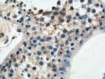 WDR40A Antibody in Immunohistochemistry (Paraffin) (IHC (P))