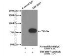 TBC1D17 Antibody in Immunoprecipitation (IP)