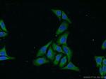 WDR32 Antibody in Immunocytochemistry (ICC/IF)