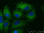 C19orf50 Antibody in Immunocytochemistry (ICC/IF)