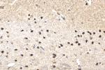 ATRX Antibody in Immunohistochemistry (Paraffin) (IHC (P))