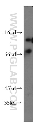 EIF2AK1 Antibody in Western Blot (WB)