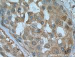 EIF2AK1 Antibody in Immunohistochemistry (Paraffin) (IHC (P))