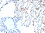 EPH Receptor B4 (EPHB4) Antibody in Immunohistochemistry (Paraffin) (IHC (P))