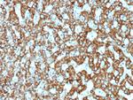 EPH Receptor B4 (EPHB4) Recombinant Rabbit Monoclonal Antibody (EPHB4/9663R)