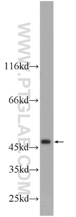ZNF557 Antibody in Western Blot (WB)