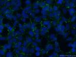 STARD3NL Antibody in Immunocytochemistry (ICC/IF)