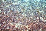 STARD3NL Antibody in Immunohistochemistry (Paraffin) (IHC (P))