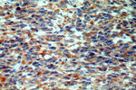 STARD3NL Antibody in Immunohistochemistry (Paraffin) (IHC (P))