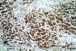 STARD3NL Antibody in Immunohistochemistry (Paraffin) (IHC (P))