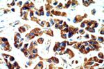 STARD3NL Antibody in Immunohistochemistry (Paraffin) (IHC (P))