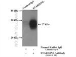 STARD3NL Antibody in Immunoprecipitation (IP)