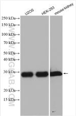 STARD3NL Antibody in Western Blot (WB)
