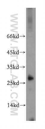 STARD3NL Antibody in Western Blot (WB)