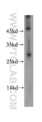 STARD3NL Antibody in Western Blot (WB)