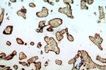 ARMC10 Antibody in Immunohistochemistry (Paraffin) (IHC (P))
