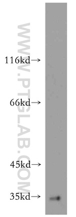ARMC10 Antibody in Western Blot (WB)