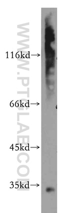 ARMC10 Antibody in Western Blot (WB)
