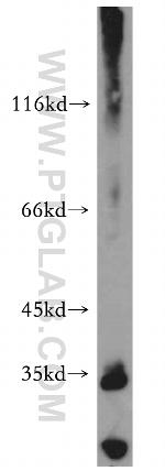ARMC10 Antibody in Western Blot (WB)