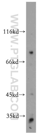 ARMC10 Antibody in Western Blot (WB)