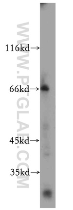 ARMC10 Antibody in Western Blot (WB)