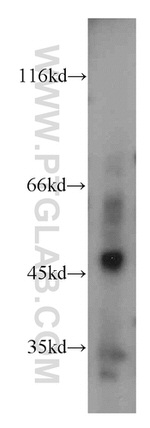 WIPF2 Antibody in Western Blot (WB)