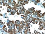 PPPDE1/PNAS4 Antibody in Immunohistochemistry (Paraffin) (IHC (P))
