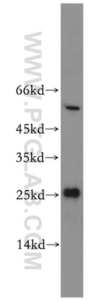 PPPDE1/PNAS4 Antibody in Western Blot (WB)