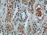 FAM164C Antibody in Immunohistochemistry (Paraffin) (IHC (P))