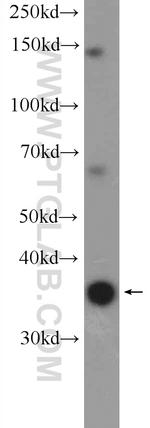 FAM164C Antibody in Western Blot (WB)