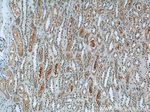 FAM164C Antibody in Immunohistochemistry (Paraffin) (IHC (P))