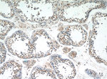 FAM164C Antibody in Immunohistochemistry (Paraffin) (IHC (P))