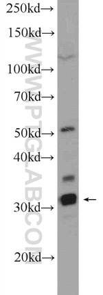 FAM164C Antibody in Western Blot (WB)