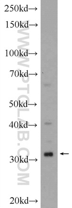 FAM164C Antibody in Western Blot (WB)