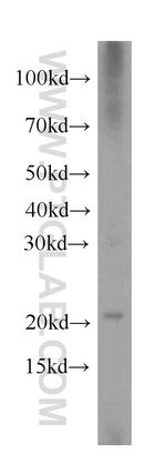Hikeshi Antibody in Western Blot (WB)
