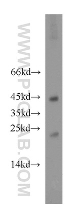 Hikeshi Antibody in Western Blot (WB)