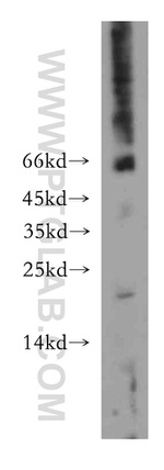 Hikeshi Antibody in Western Blot (WB)