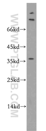 AKR1CL2 Antibody in Western Blot (WB)