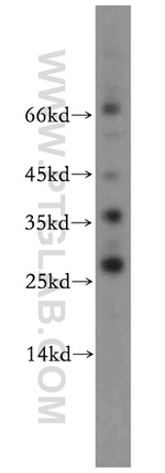AKR1CL2 Antibody in Western Blot (WB)