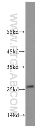 EIF1AD Antibody in Western Blot (WB)