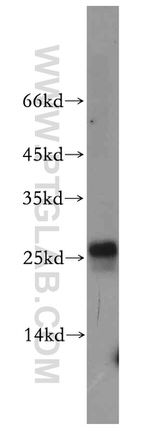 EIF1AD Antibody in Western Blot (WB)