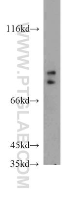 FOXP2 Antibody in Western Blot (WB)