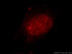 ZXDC Antibody in Immunocytochemistry (ICC/IF)