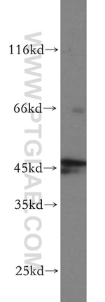 RUNDC3A Antibody in Western Blot (WB)