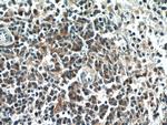 EFS Antibody in Immunohistochemistry (Paraffin) (IHC (P))