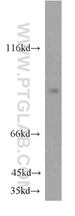 EFS Antibody in Western Blot (WB)