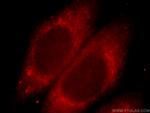 SH3BP1 Antibody in Immunocytochemistry (ICC/IF)
