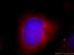 SH3BP1 Antibody in Immunocytochemistry (ICC/IF)