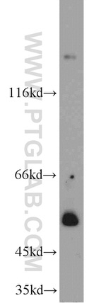 SH3BP1 Antibody in Western Blot (WB)